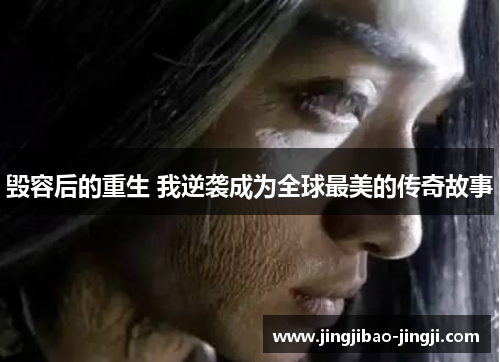 毁容后的重生 我逆袭成为全球最美的传奇故事